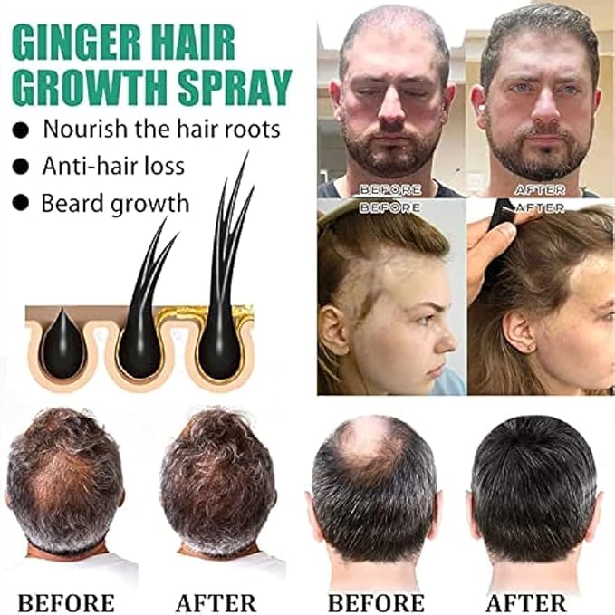 Shougagro Japanese Ginger Ginseng Hair Growth Serum Spray, HyunGang Korea Hair Regrowth Spray for Men Women (2 Pcs)