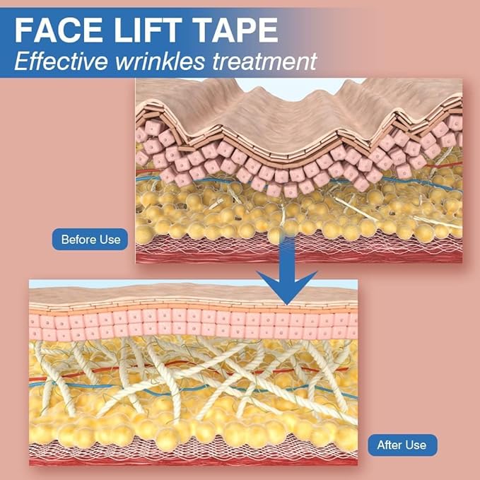 Facial Patches - Wrinkle Patches - Wrinkle Tape - Face Lifting Tape - Non-Invasive Wrinkle Remover - Multifunctional High Elasticity Wrinkle Forehead Eyes Face (Beige-2.5cm)