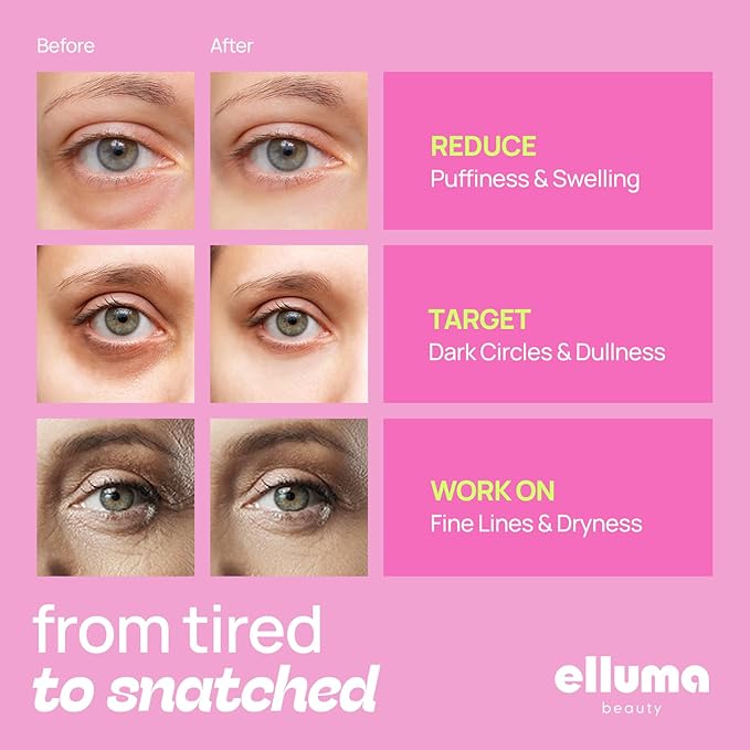 Under Eye Patches | Eye Mask for Puffy Eyes & Dark Circles, Hydrogel Eye Gel Pads with Menthol & Taurine, 12 Pairs