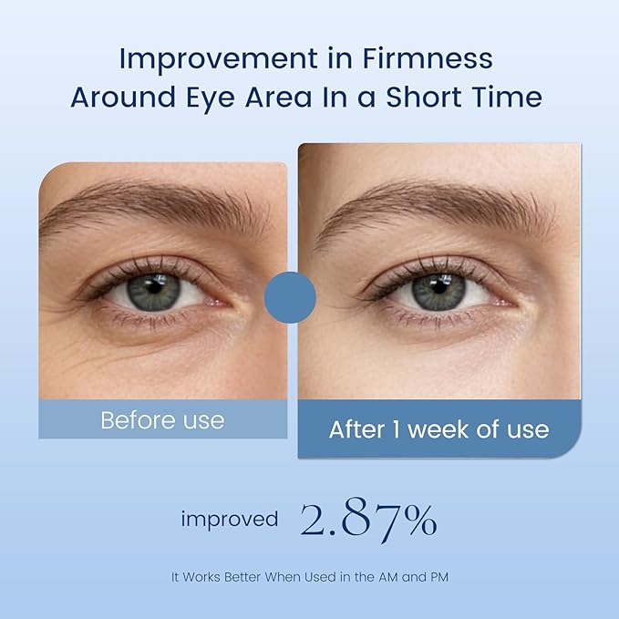 3-in-1 Retinol Eye Cream with Hyaluronic Acid & Niacinamide, Anti Aging Under Eye Treatment for Dark Circles Puffiness Fine Lines Wrinkles, Lightweight Hydrating Brightening Eye Care for Men Women