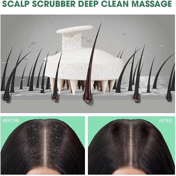 Scalp Massager Brush for Hair Growth – Silicone Scalp Scrubber & Scalp Exfoliator – Manual Scalp Massager Brush for Wet or Dry Use – Hair Massager Scalp Shampoo Brush Tool (Beige)