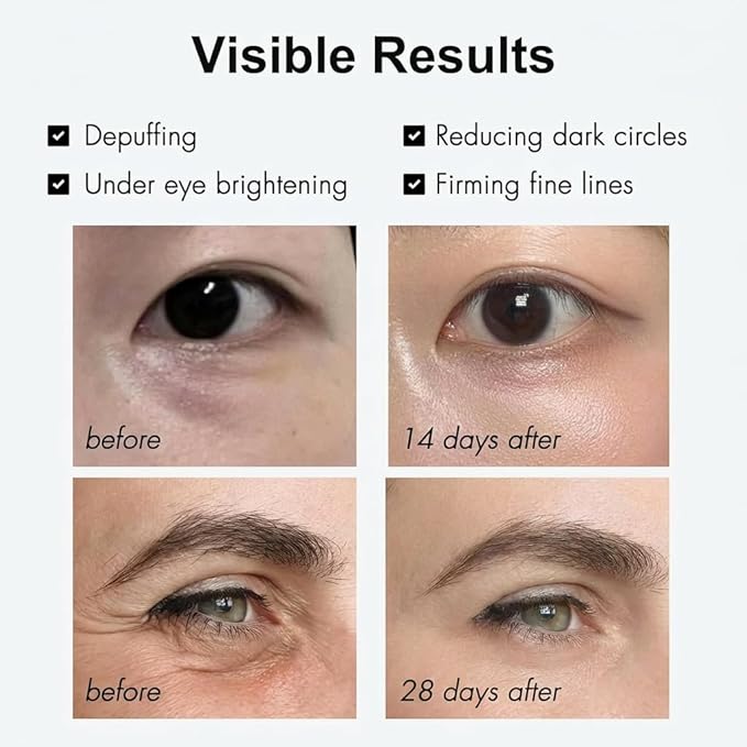 Loxadz Under Eye Brightener Serum with Cooling Rollerball, Zero Irritation Retinol Eye Cream for Puffy Bags, Fine Lines and Wrinkles, Hydrating Massage Roller for Dark Circles, 0.52 fl.oz