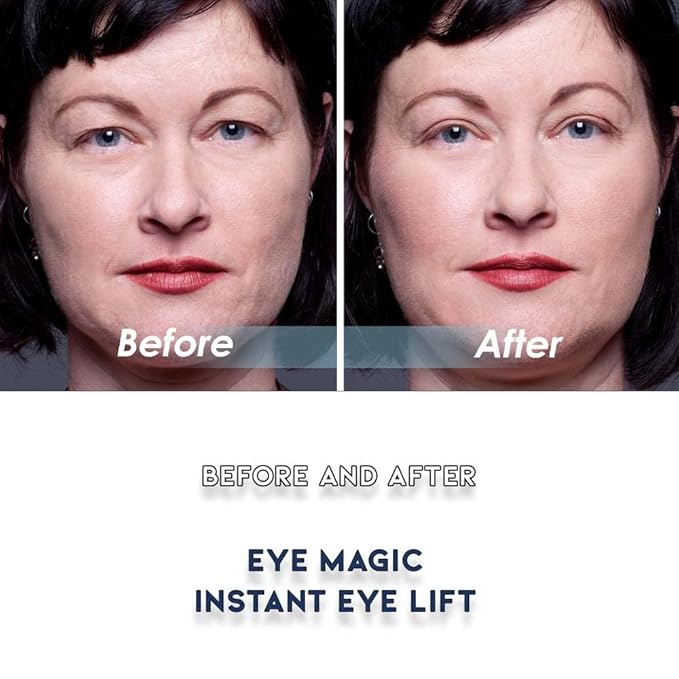 Eye Magic Premium Eye Lift Strips - Small Size, 88 Count Pack, Strips Only (no gel), for Smaller Eyelid Sizes, Instant Non-Surgical Lift, Made in USA