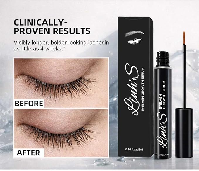 LINH’S Eyelash Growth Serum – Lash Enhancing Serum for Longer, Fuller Looking Lashes, Biotin & Peptides, For Thin & Short Lashes, Oil-Free, Vegan, Cruelty-Free, 5ml