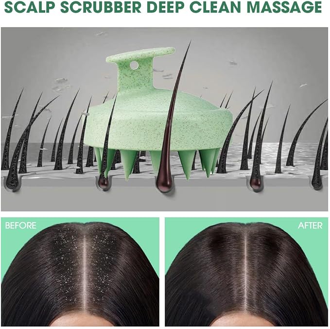 Scalp Massager Brush for Hair Growth – Silicone Scalp Scrubber & Scalp Exfoliator – Manual Scalp Massager Brush for Wet or Dry Use – Hair Massager Scalp Shampoo Brush Tool (Green)