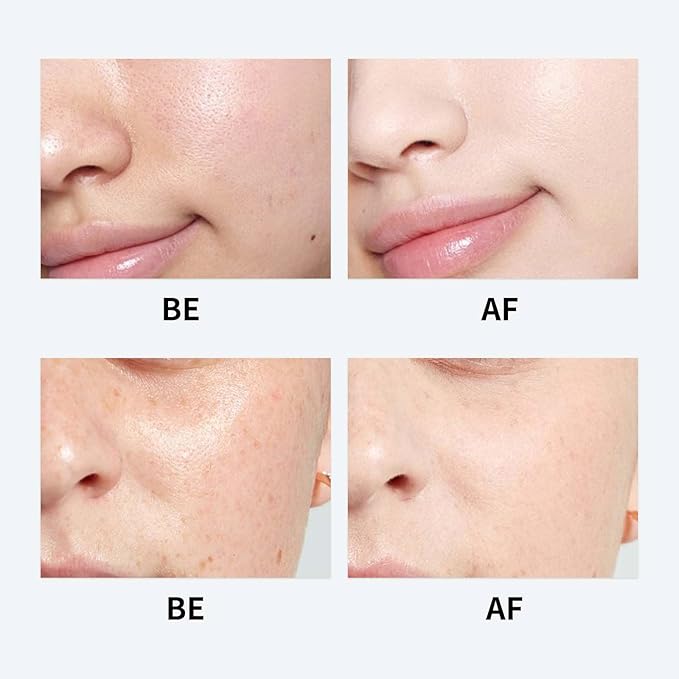 Youthful Formula Ultimate Moisturizing Cream, Cream Korean, Youthful Formula Moisturizing Cream Cream,For All Skin Types 100ml/1pcs