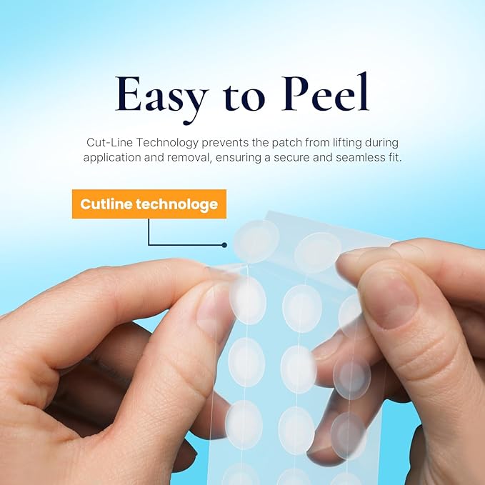Discreet Acne Pimple Patch | Spot Cover & Treatment Solution Cystic Acne & Pimple | Hydrocolloid Facial Stickers | Waterproof Patches Invisibly Cover Pimples (2packs)