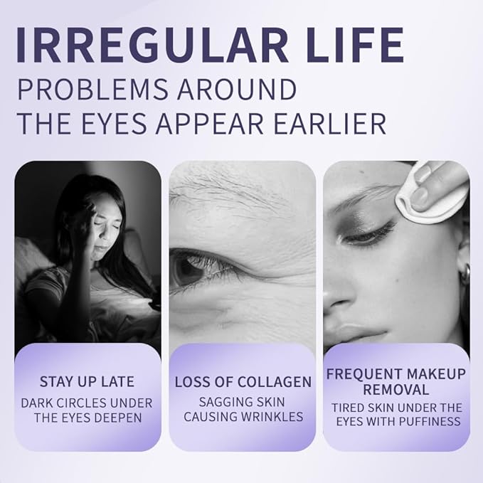 Eye Cream & Roller Serum Set with Retinol,Vitamin E,Squalane, Hyaluronic Acid for Dark Circles, Eye Bags & Fine Lines Under Eyes, Brighten Under Eyes,1OZ&0.27OZ
