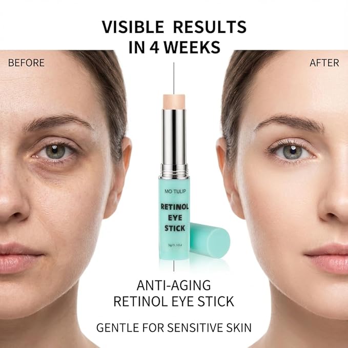 Retinol Eye Stick Balm, Retinol Eye Cream – Anti-Aging Formula Reduces Fine Lines, Dark Circles & Puffiness, Hydrates Delicate Skin – Visible Results in 4 Weeks, Gentle for Sensitive Skin