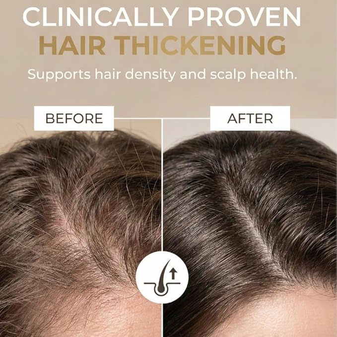 Placenta Hair Growth Treatment 12 x 10 ml - Nettle Ampoules for Hair Loss and Follicles Regrowth - Placenta Serum Enriched with Panthenol and Eucalyptus - Soothing Scalp Treatment