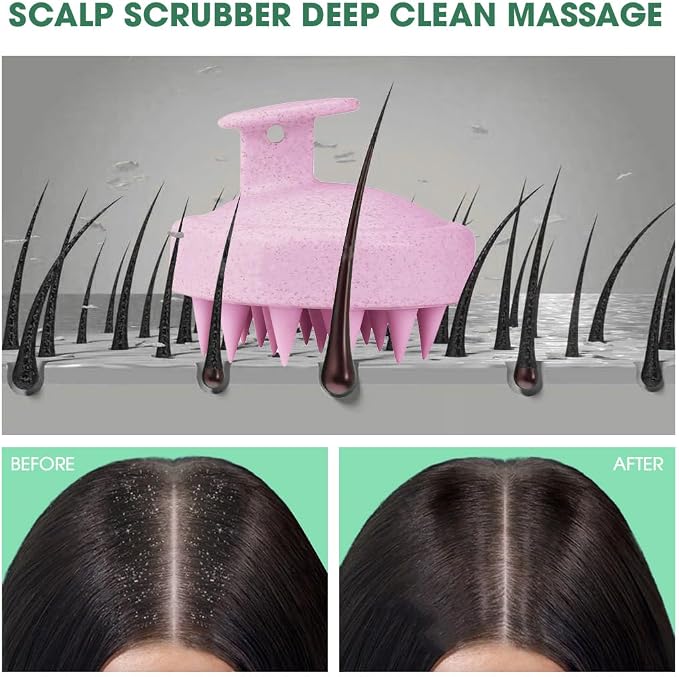 Scalp Massager Brush for Hair Growth – Silicone Scalp Scrubber & Scalp Exfoliator – Manual Scalp Massager Brush for Wet or Dry Use – Hair Massager Scalp Shampoo Brush Tool (Pink)