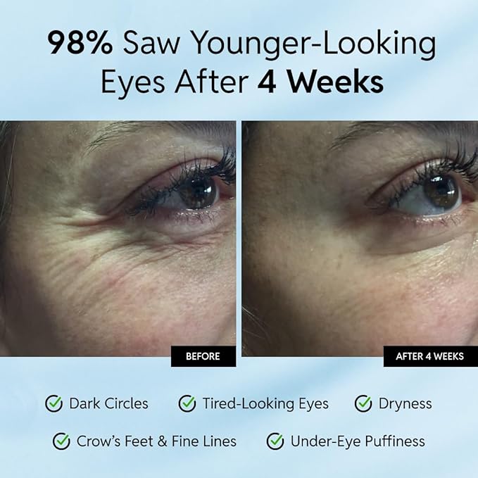 Eliré Anti-Aging Eye Cream - Smooths Wrinkles, Firms and Hydrates - With Ceramides and Caffeine - Reduces Fine Lines and Puffiness - Fast-Absorbing, Invisible Under Makeup - 15ml