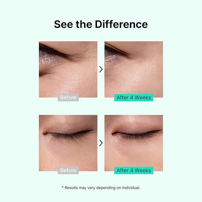 TIAM Vita A Bakuchiol Firming Eye Cream, 1.01 fl oz, Retinol Alternative Anti-Aging Cream for Wrinkles, Dark Circles, and Puffiness, Fragrance-Free Under-Eye Cream, Korean Skin Care