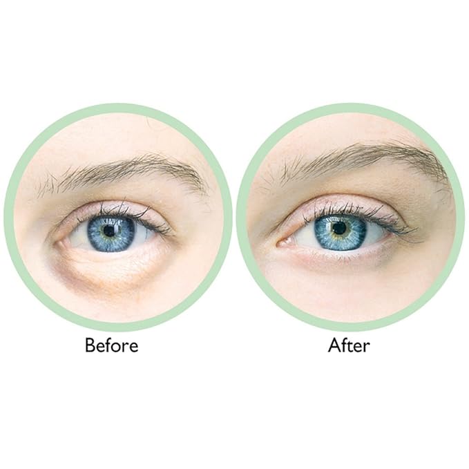 (Set/2) Puffy Eye Relief Powerful Roll-on Cools Skin Reduces Under Eye Bags