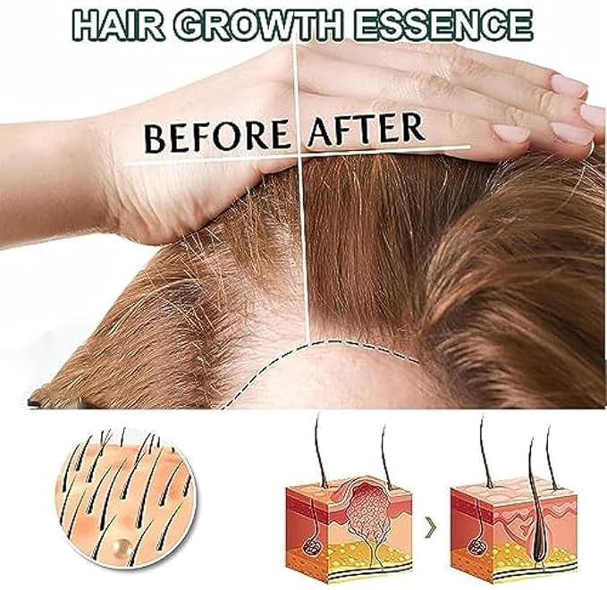 Shougagro Japanese Hair Growth Ginger Spray for Men Women, HyunGang Korea Ginseng Hair Regrowth Serum Spray, (3 Pcs)