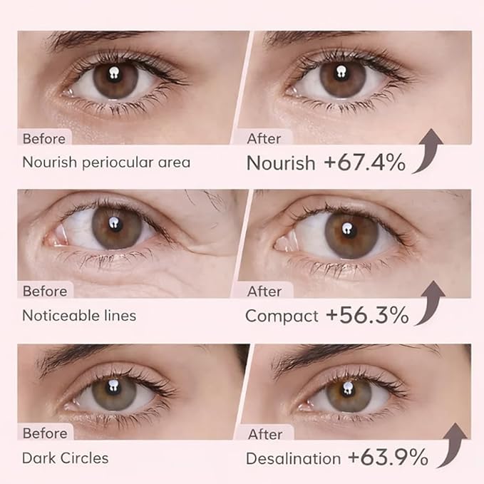 Aurova Beauty Eye Mask, Aurova Collagen Full Eye Masks, 360 Full Coverage Eye Patches with Collagen & Vitamin C, Nourishing and Non Irritating, For Puffy Eyes and Dark Circles, 5 Pairs