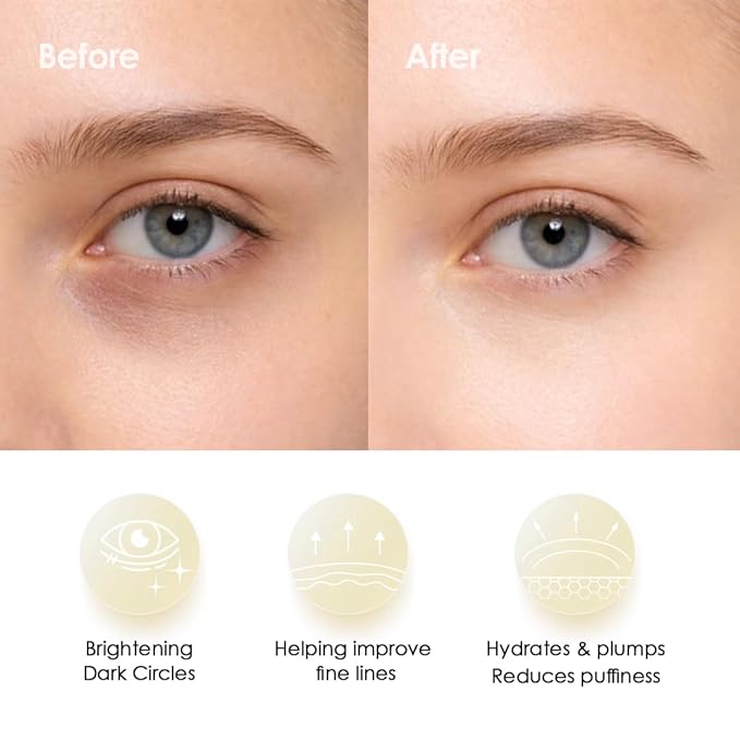Sweet Dreams Collagen Glow Gold Eye Masks l Korean Under Eye Patches Puffy Eyes, Dark Circles & Wrinkles | Collagen, Niacinamide, Hyaluronic Acid & Peptides | Hydrating Eye Treatment& Self Beauty Care