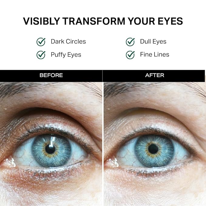 Y’OUR Retinol & Peptide Complex Eye Cream: Anti-Aging for Dark Circles, Puffiness, Wrinkles & Crow’s Feet; Hydrating & Under Eye Repair. Made in USA. Gifts for Women
