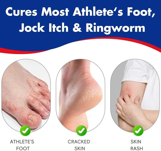 Clotrimazole Antifungal Cream 1% USP (1 oz), Anti Fungal Treatment, Relieves Itching, Burning, Cracking and Scaling Associated Athletes Foot