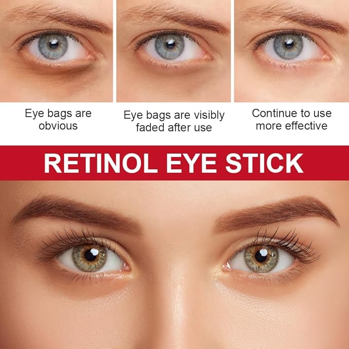 Retinol Eye Stick with Collagen,Hyaluronic Acid for Dark Circle, Wrinkles,Eye Balm Moisturizes Anti Aging,Visible Results in 3-4 Weeks, Retinol Eye Cream For Puffiness and Bags Reduces Fine Lines