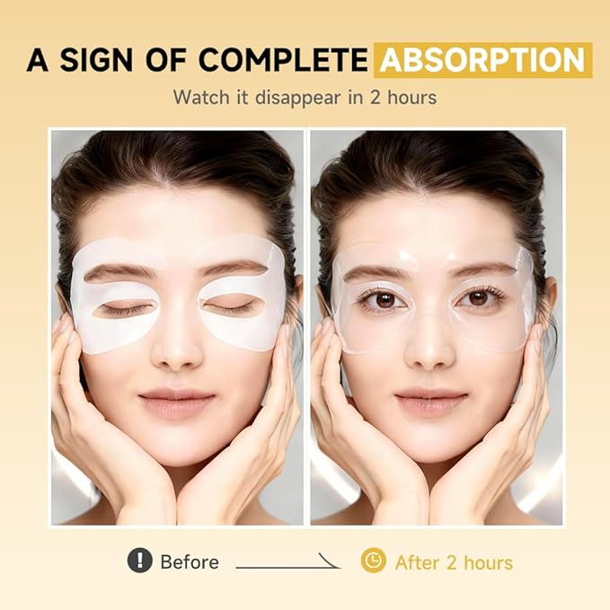 4 Pairs 5% PDRN Under Eye Patches, 6-in-1 Bio-Collagen 360° Eye Patches for puffy eyes, dark circles & Wrinkle | 2% Caffeine, Kojic acid, Retinol, Hyaluronic, Niacinamide | Korean Popular Eye Mask
