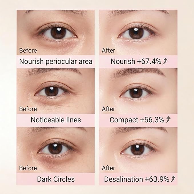 Aurova Beauty Eye Mask, 360° Full-Eye Lift Mask, Eye Mas with Collagen & Vitamin C, Nourishing & Non Irritating, for Puffy Eyes and Dark Circles (7 Pairs/14 Pieces)