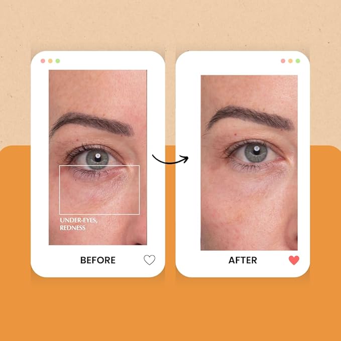 Gold Eye Patches, Under Eye Patches for Puffy Eyes and Dark Circles, Collagen-Infused Gel Eye Masks, Gifts for Women, Improving Fine Lines and Wrinkles, Eye Bags Treatment (24 pairs)