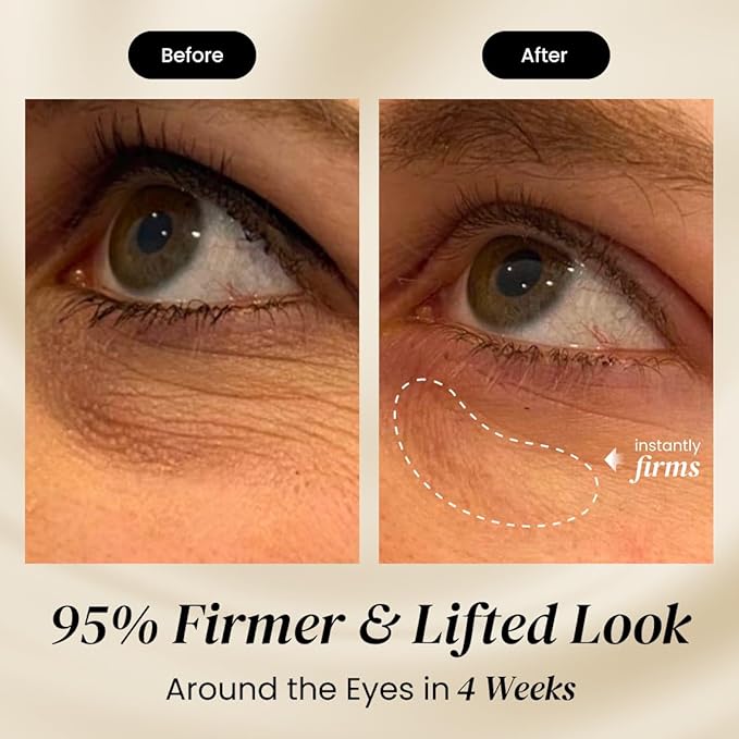 Eliré Firming Eye Cream - Instant Lift and Tightening Treatment - Arginine/Lysine Peptides + Ceramide - Reduces Fine Lines, Wrinkles, Under-Eye Bags - Lightweight, Works Under Makeup - 15ml