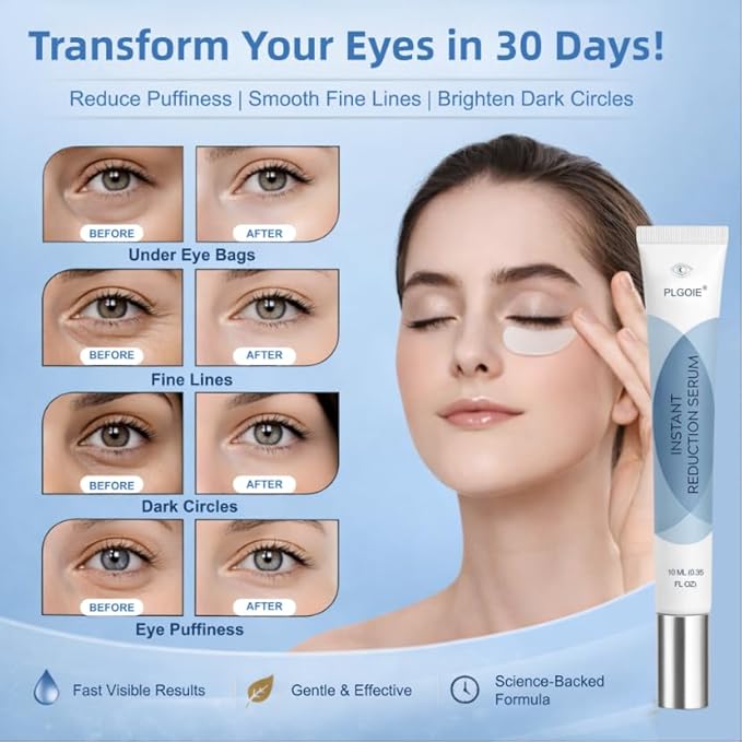 Retinol Eye Cream, Retinol and Peptides for Instant Firming Eye Serum | Fast Absorbing, Correction for Puffy Eye Bags Fine Lines Dark Circles Wrinkles – Anti-Aging Wrinkle Remover