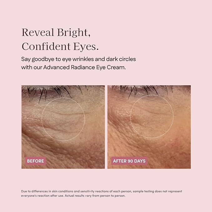 Botanic Pretti5 Advanced Radiance Eye Cream–Dark Circle Remover & Under Eye Wrinkle Repair for Sensitive Skin–Anti-Aging Japanese Lifting Treatment with Caffeine & Yuzu–Made in Japan & Vegan–12g