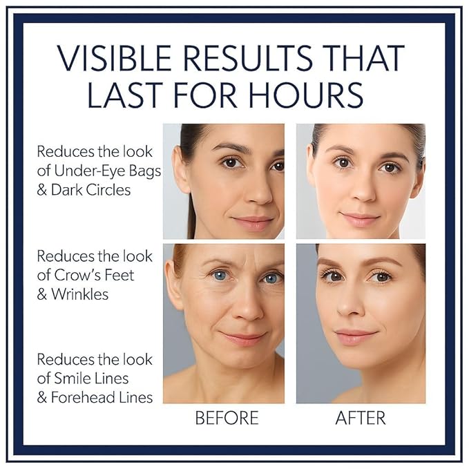 Instant Firming Eye Serum|Anti-Aging Formula for Under Bags and Wrinkles, Under Eye Cream-10ml, Wrinkle Filler, Visibly Improves for Bags Dark Circles Treatment for Puffines (Perfume Free)