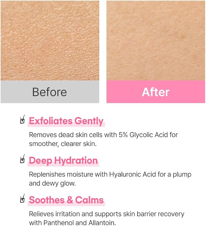 Hanskin Hyaluron Exfoliating AHA Treatment – Korean Exfoliating Toner with Glycolic & Lactic Acid for Smooth, Hydrated, Glass Skin | pH-Balanced Daily Skin Booster for Dull, Dry Skin, 5.07 fl oz