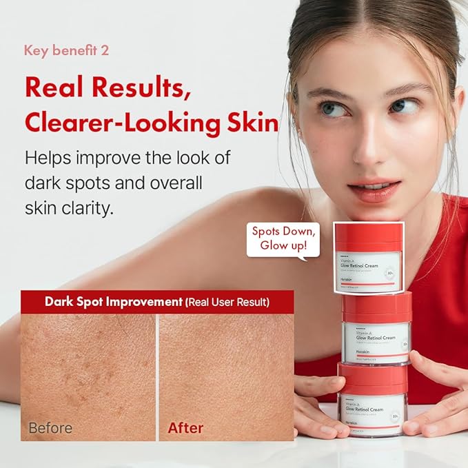 Hanskin Retinol Facial Cream, Repair Fine Lines & Wrinkle, Anti Aging Retinol Moisturizer for Face, For Smoothing Firming Revitalizing Radiant Glow Skin, Korean Skincare, 50ml/1.69 FL Oz