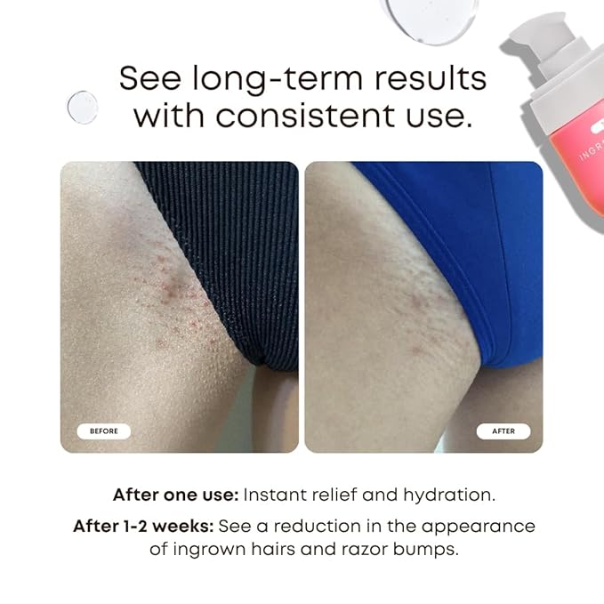 Bushbalm Ingrown Hair Oil - Helps Prevent and Repair Skin from Ingrown Hairs, Razor Burn & Underarm Bumps - Soothe Skin from Post Shave Itchiness, Irritation and Redness, 30 ml - Watermelon Sugar Oil