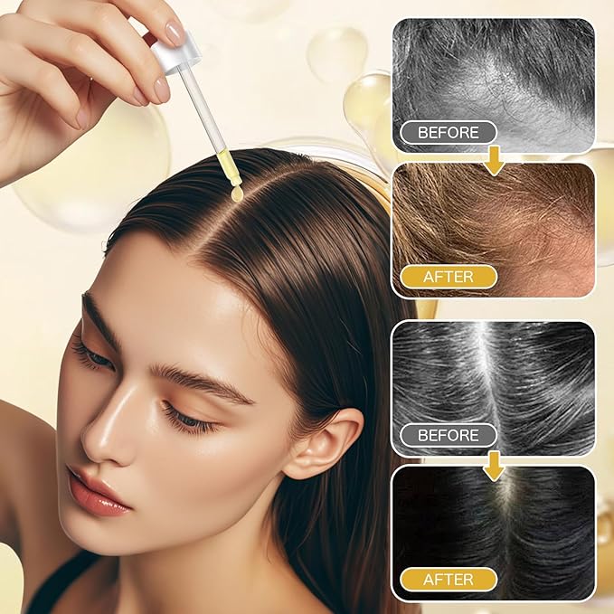 Natural Hair Growth Oil Kit with Rosemary Hair Oils for Hair Growth for Dry Damaged Hair, for Men and Women 2PCS*2 fl.oz (Yellow)