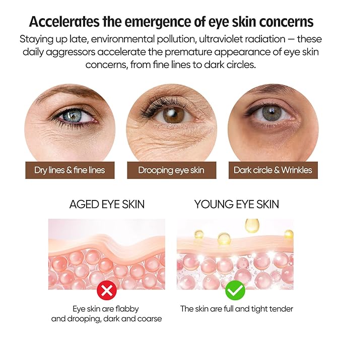 Dark Circle Eye Cream for Women Who Often Stay Up Late: Reduces Puffiness and Bags Under Eyes - with Caffeine Retinol Niacinamide