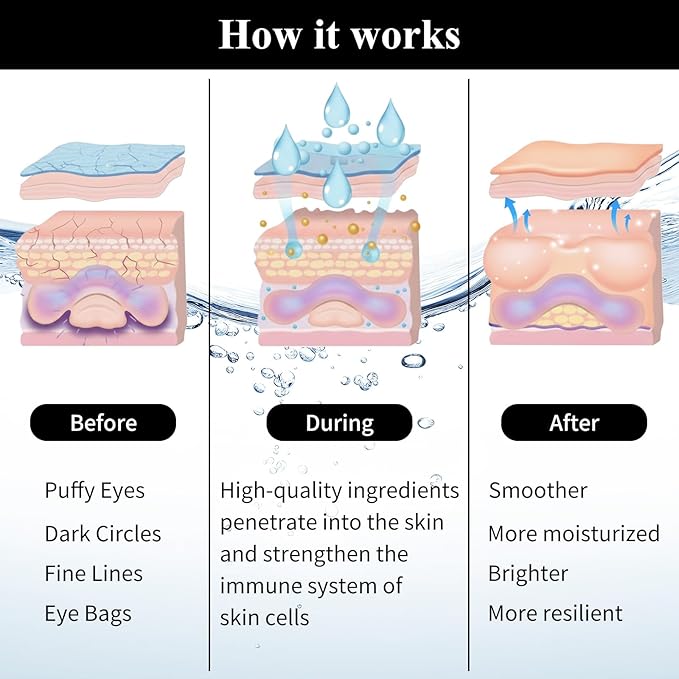 SPRINGSKY Under Eye Patches,Lace Eye Mask for Puffy Eyes and Dark Circles,Collagen Skin Care Products,Hydrating,Smoothing,Anti-Aging Eye Patch for Under Eye Bags（24 Pairs）