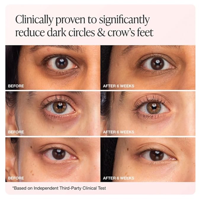 Innbeauty Project Bright & Tight Eye Cream with Vitamin C & Peptides for Dark Circles & Firming, 0.5 OZ (15ml)