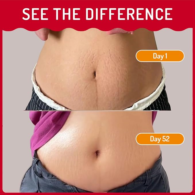 Stretch Mark Oil for Pregnancy Massages Body & Reduces Scar Appearance, Removes Stretch Mark Prevention, Prenatal & Postnatal Tummy Skin Care, Firming Skin Elasticity for Maternity, 2.03oz(1Pack)