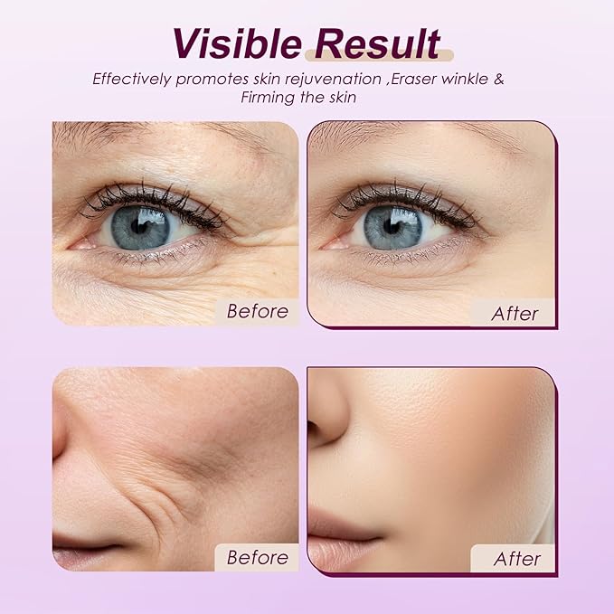 Calcium Volume Multi Balm Stick + Pink Spicule Serum + Eye Patches 60ea,Collagen Elastin Boost & Wrinkle Smoothing Eye Treatment,Skin Condition Improvement Pore Refining Serum,Gentle Skincare Routine