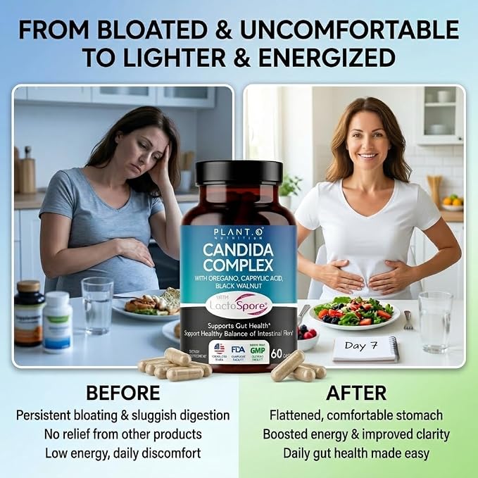 Candida Cleanse Supplement & Yeast Support with Probiotics (LactoSpore®), Oregano Oil, Caprylic Acid, Black Walnut – Advanced Gut Health, Digestive Enzymes, pH Balance for Women and Men – 60 Capsules
