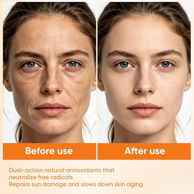 Vitamin C Oil with Squalane, Jojoba & Olive Oils - Hydrating Vitamin C Oil for Face & Body, Multi-Purpose Moisturizer with Natural Antioxidants, For Dry, Sensitive & All Skin Types, 3.38 Fl Oz