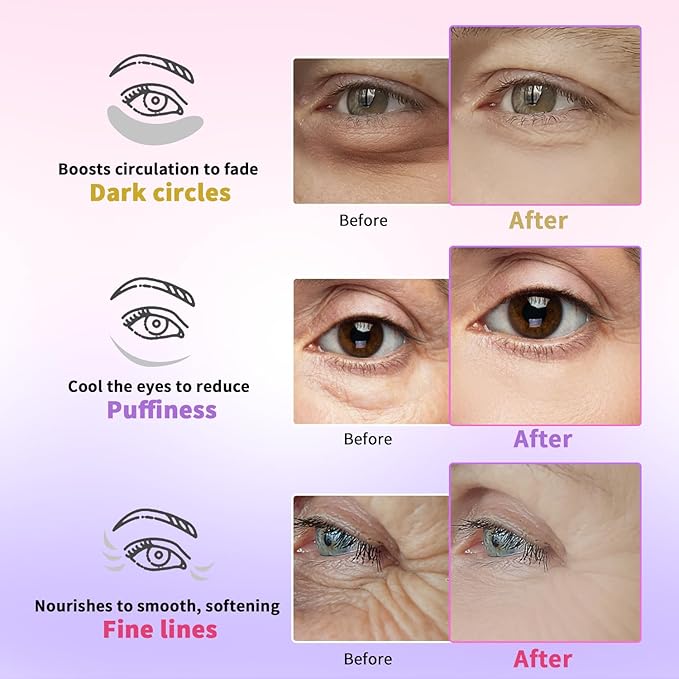 AILEORY Under Eye Patches for Dark Circles, Puffiness, Fine Lines, Eye Mask Set with Retinol, 24K Gold, Caffeine, Gel Mask for Birthday & Mothers Day Gifts, Skincare Gift for Women & Men, 24 Pairs