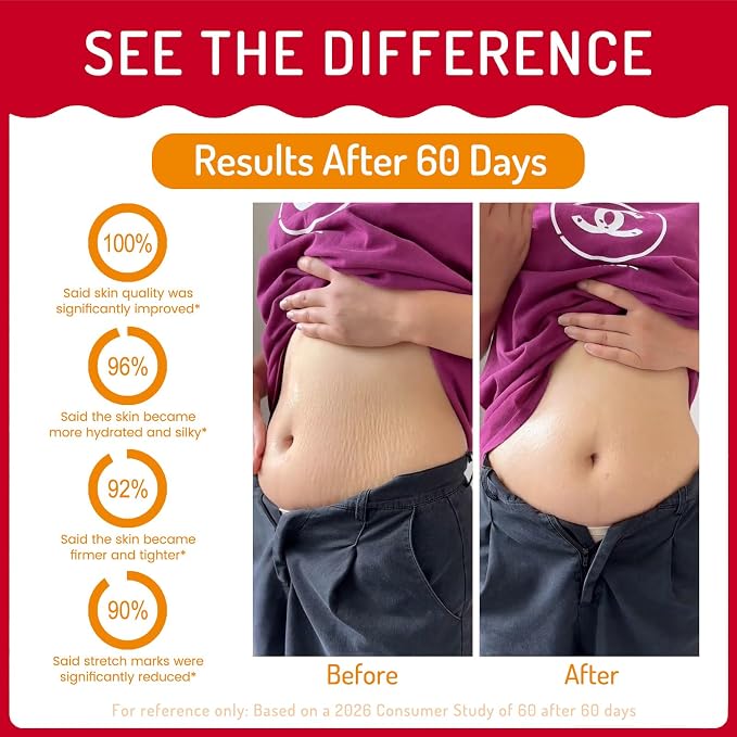 Stretch Mark Oil for Pregnancy Massages Body & Reduces Scar Appearance, Removes Stretch Mark Prevention, Prenatal & Postnatal Tummy Skin Care, Firming Skin Elasticity for Maternity, 2.03oz(Pack of 2)