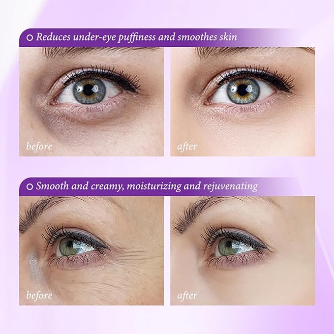 Under Eye Cream for Dark Circles and Puffiness – Pro-Xylane Eye Cream Anti Aging Hydrator to Smooth Fine Lines & Wrinkles, Refresh Tired Eyes, Lightweight Daily Eye Treatment 15g/0.5oz