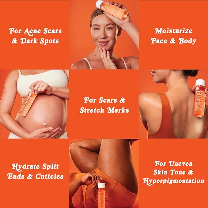 Bio-Oil Skincare Body Oil Serum for Scars and Stretch Marks, Face and Body Moisturizer with Vitamin E & A for Sensitive Dry Skin, Dermatologist Recommended, Non-Comedogenic, 2 oz, Case of 24