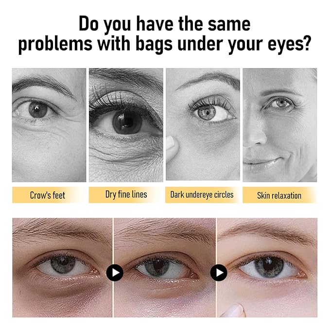 Temporary Instant Eye Tightener Cream - Reduces Bags & Puffiness, Smooths Wrinkles & Fine Lines in Minutes, Temporary Lift & Firm Under-Eye Area, Advanced Lightweight Formula, 1 Fl oz / 30ml