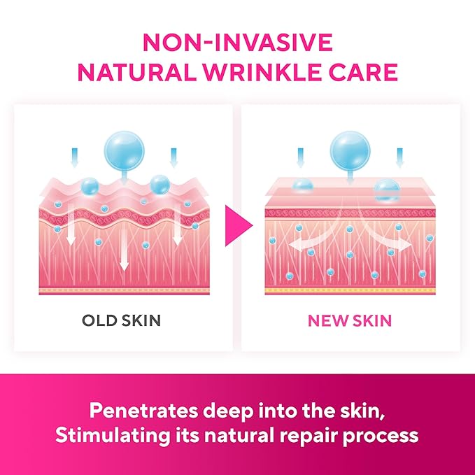 SILKDERMIS Silicone Face and Forehead Wrinkle Patches: Facial Wrinkle Patch for overnight and Smile Line and Under Eye Patches Forehead Wrinkle Treatment (Red(1 Count (Pack of 5)))