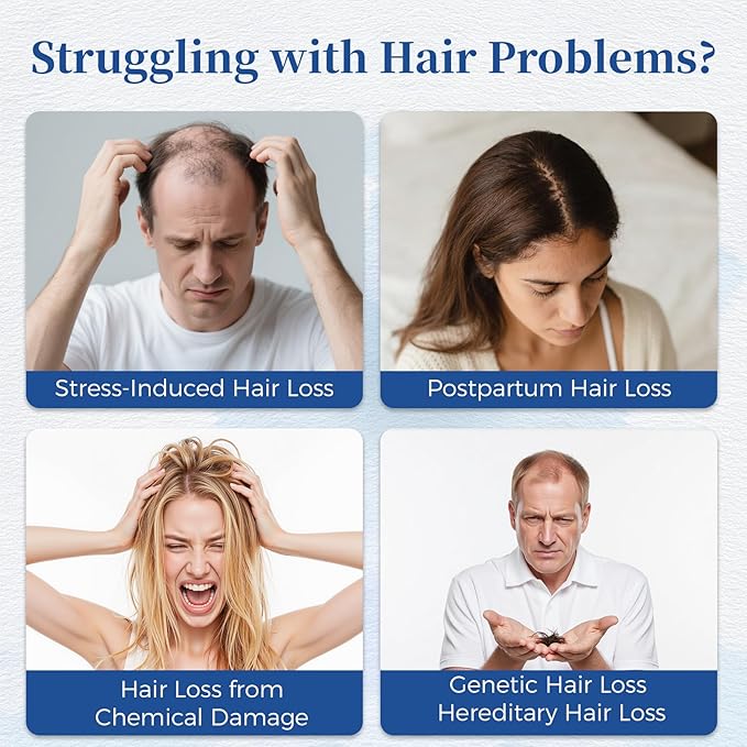 Hair Growth Serum Roll On with Rosemary，Helps Support Thicker, Fuller Hair Appearance，Clean, Non-Greasy Hair Loss Support for Men & Women，Saw Palmetto，0.84 Fl Oz (Pack of 3)