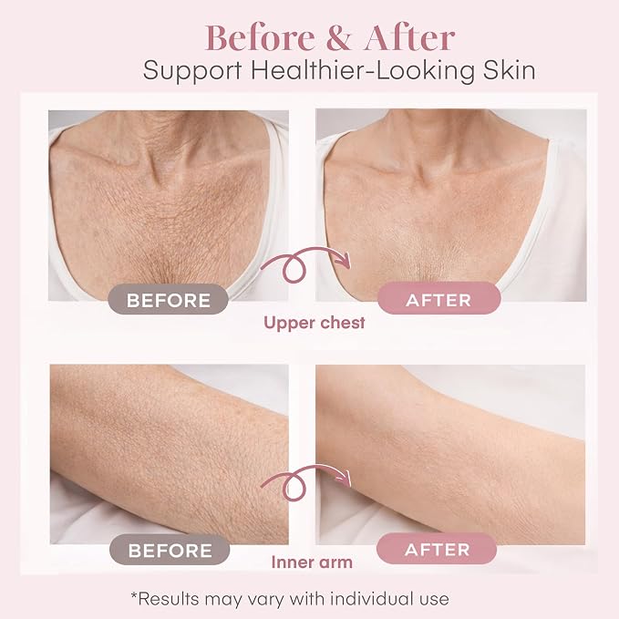 Bioidentical Estrogen Cream for Women with E3 - Menopause Skin Support Body Moisturizer with B5, Wild Yam, Vitamin C & CoQ10 - Up to 100 Pumps Supply